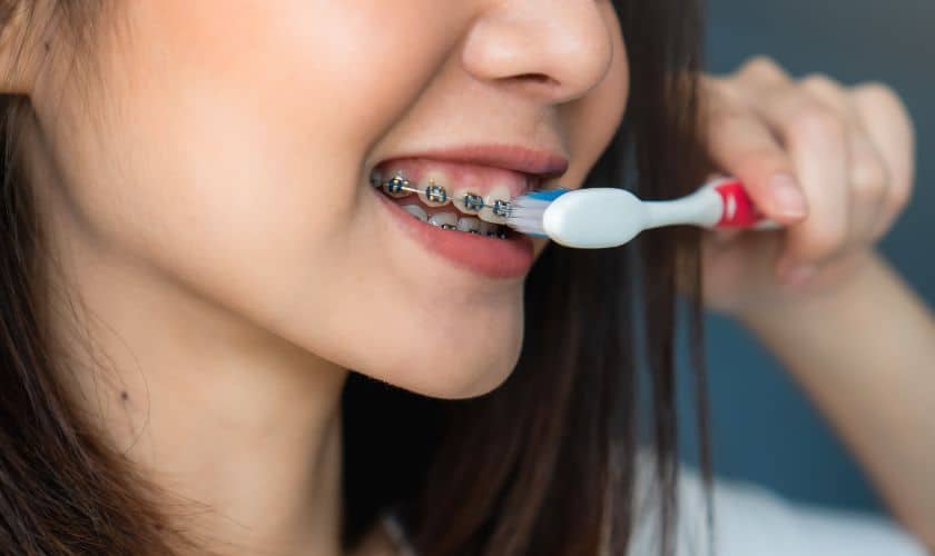 Oral Hygiene During Orthodontic Treatment