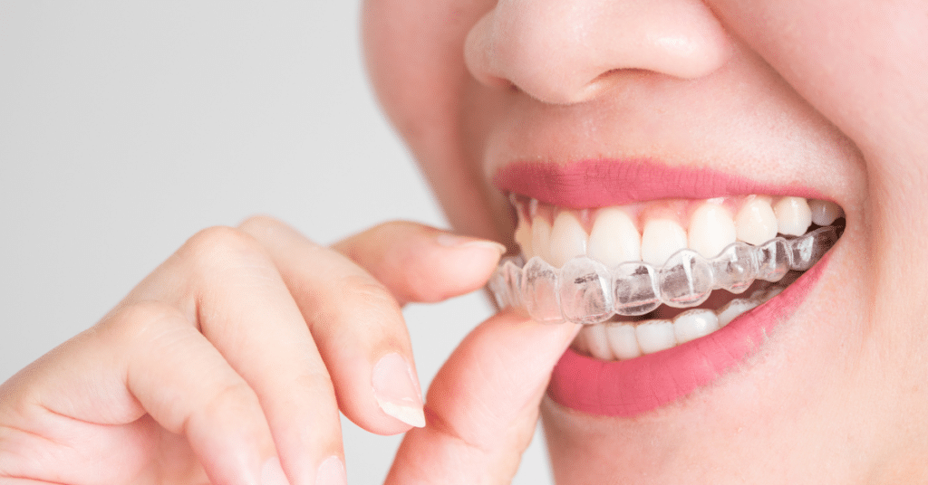 Choosing the Right Orthodontist in Tulsa: Your Path to a Beautiful Smile