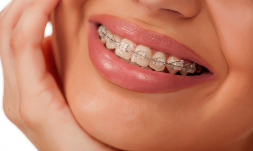 Life with Braces: What to Expect During Your Orthodontic Journey in Tulsa